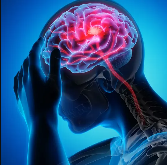 Stroke analysis